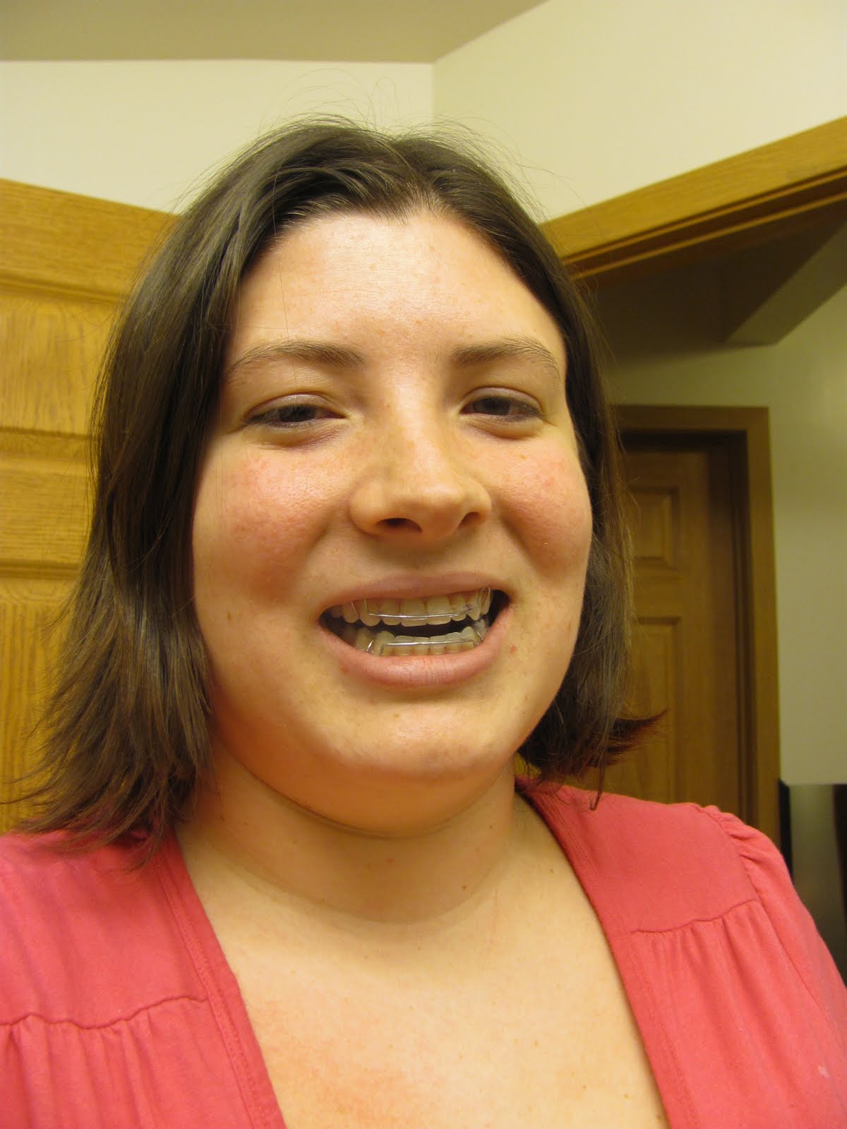 My Orthognathic Surgery Journal