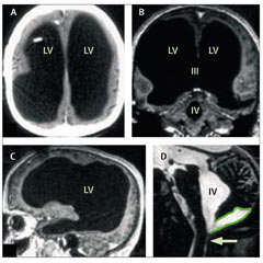 [cerebro.jpg]