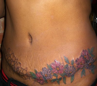 Tattoo Fading Tattoo Fading