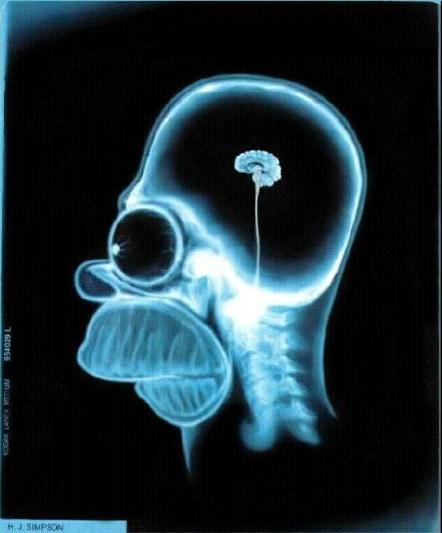 [homer-x-ray.jpg]