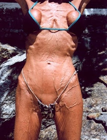 anorexic, anorexia, body, woman