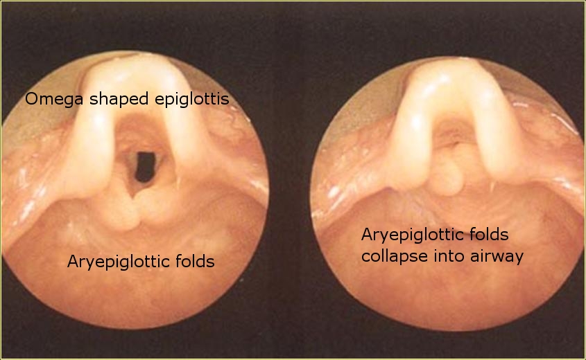 Cat Epiglottis