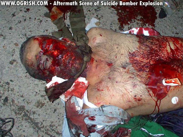 ogrish-dot-com-suicide_bomber_explosion_aftermath6.jpg.