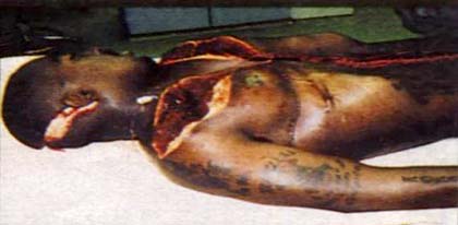 tupac autopsy photo