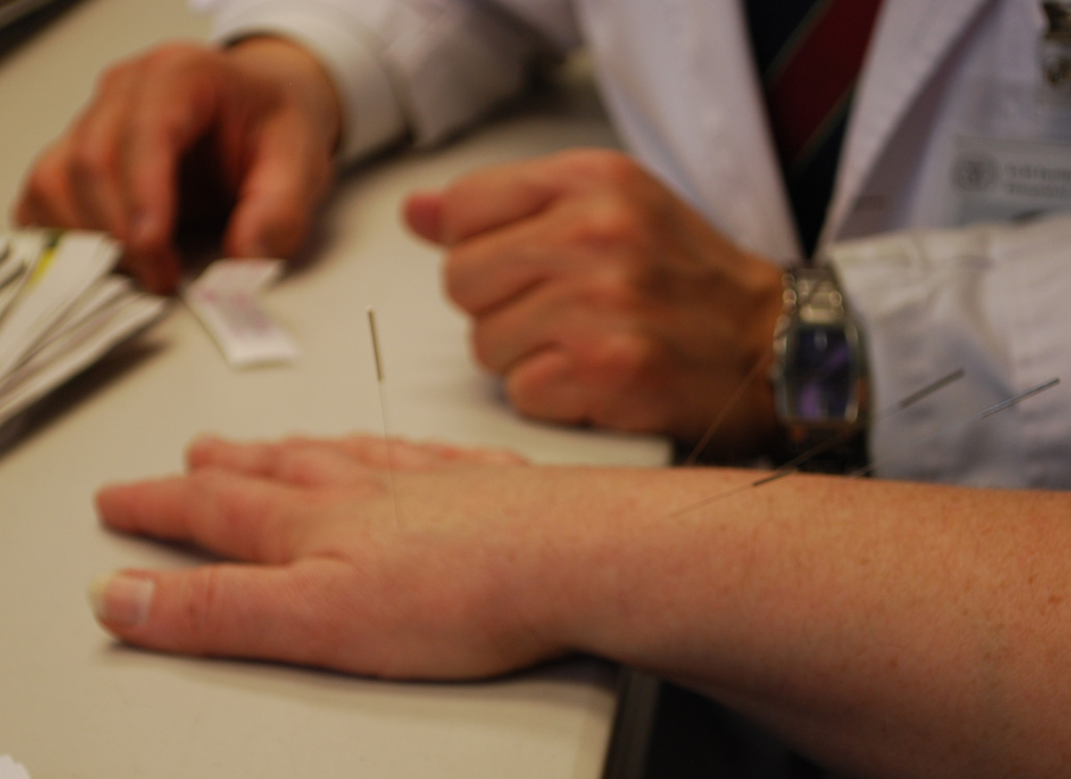 All Things Korean American Does Acupuncture Hurt?