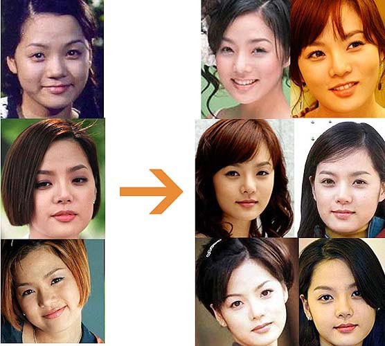 hey hey hey: [ Park Chae Rim ] Before & After Plastic Surgery