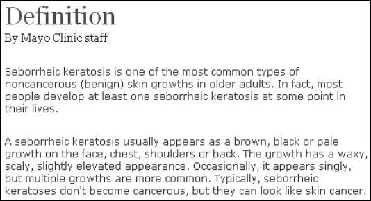 From the Mixed-up Files of the Siegels: Old-age Barnacle!