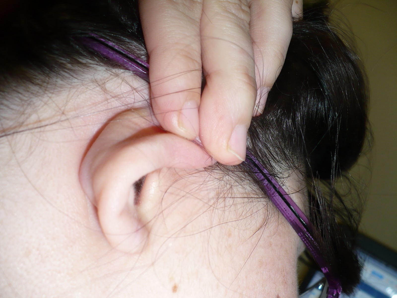 Ear Pimple