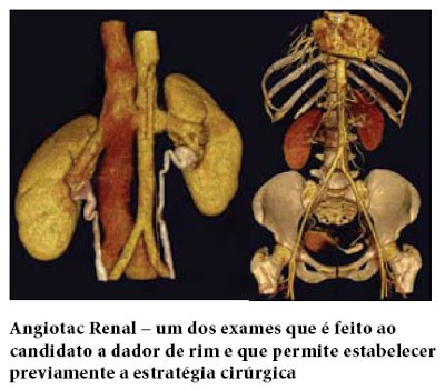 Exame de rim