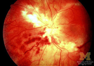 IT'S A DOC'S LIFE (geddit?): Food For Thought