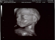 Cade's 22 Week 3D Ultrasound