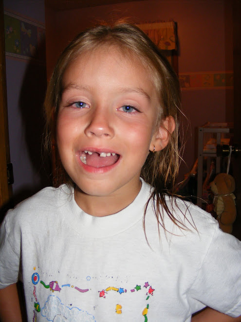 Missing Tooth!