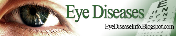 The Eye Disease Expert