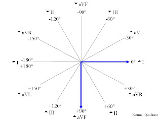Cardiac Axis Determination Part 6 Ems 12 Lead