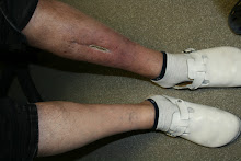 My biker's legs 10 days ago