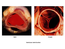 Vena Cava