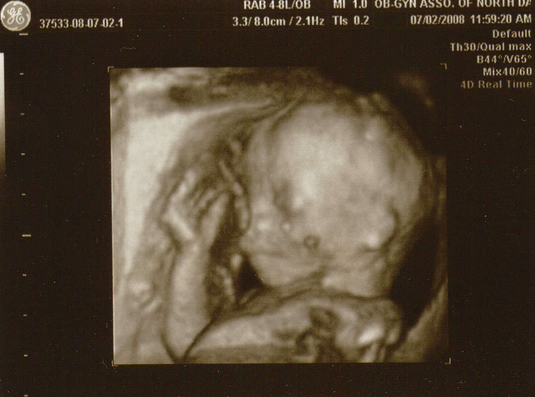 [babynew3.jpg]