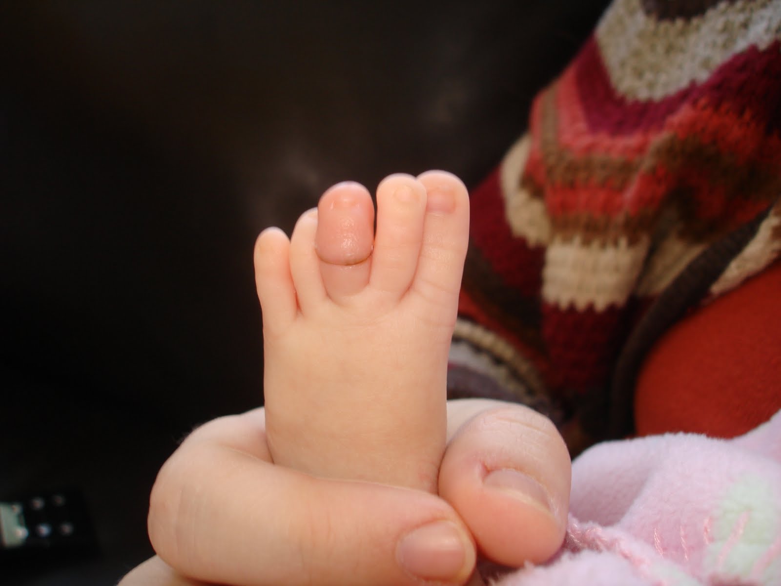 Kristi's Blog Ever heard of a Hair Tourniquet?