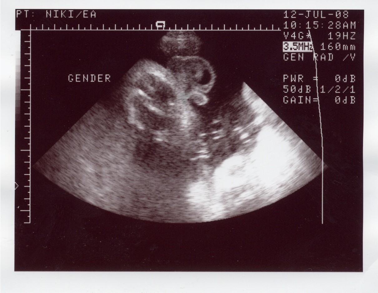 [Baby+Boy+3]