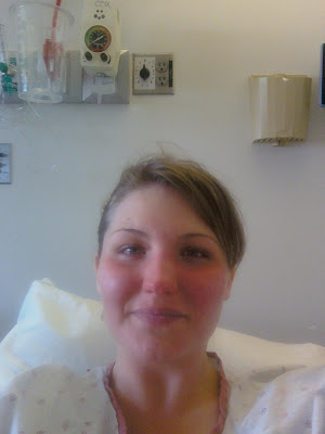 occurrence for heat rashes toddler heat rash pictures. occurrence for heat rashes