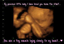 Our precious baby girl...