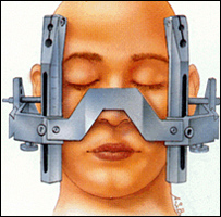 [_deep_brain_stimulation.jpg]