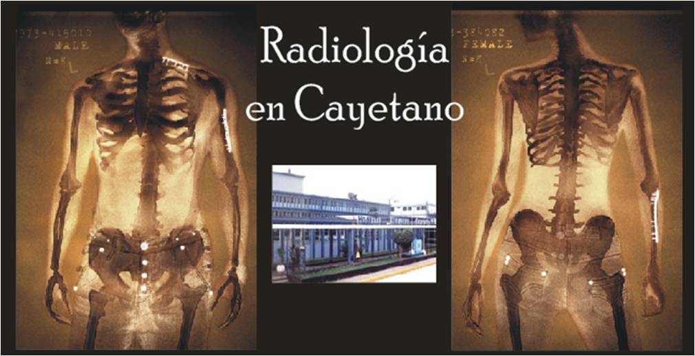 Radiologia en Cayetano