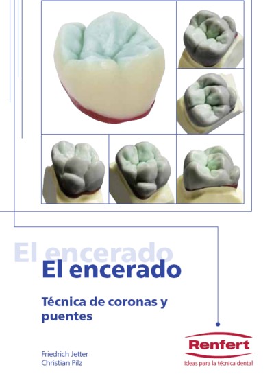 Manual De Encerado Dental