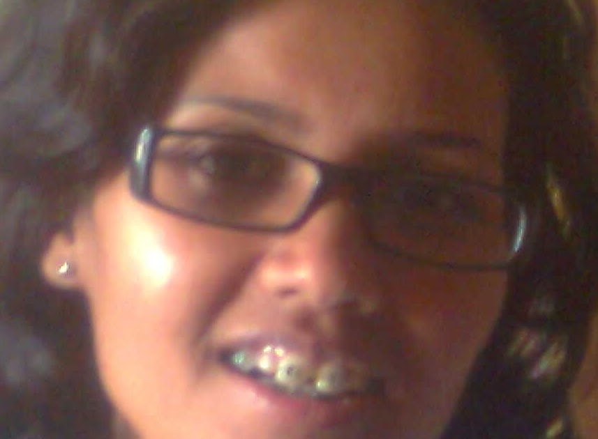 Miracle Does Happen In Life!!! My Dental Story-Part II