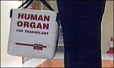 The decent ones on organ trading