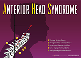In many cases, AHS may be the underlying cause of a large variety of In many cases, AHS may be the underlying cause of a large variety of
