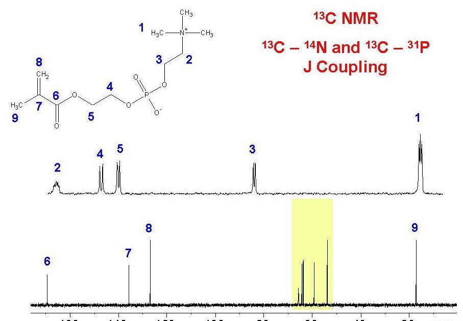 University of Ottawa NMR Facility Blog 13C Showing J Coupling to Both