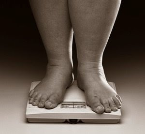 Obese Feet