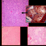 HISTOLOGÍA