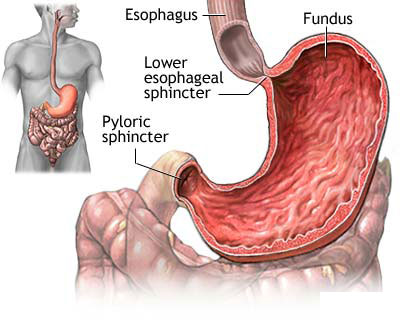 stomach-cancer-kanker-lambung.jpg