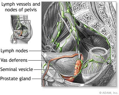 Prostate Cancer Journal: Prostate Cancer Staging