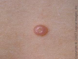 Are Ladybugs Poisonous