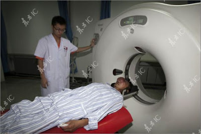 جيانغون ذو الأنف الضخمة يعاني من سرطان الأنف  Rhino+carcinoma+%282%29