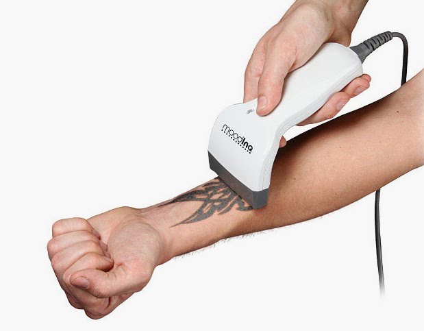 The moodINQ programmable tattoo system helps take the regret out of 