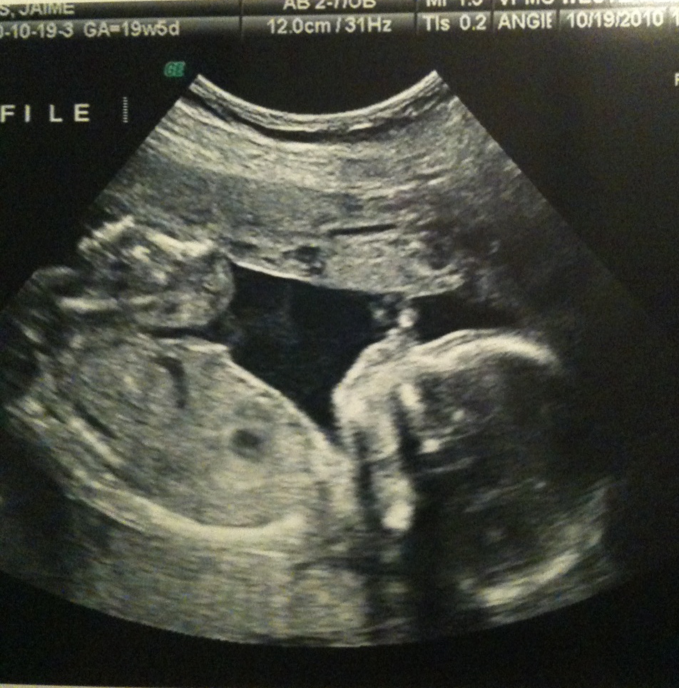 Collection 95+ Pictures Scan Pictures Of Baby Boys Stunning 10/2023