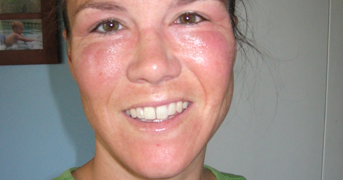 A Crafty Mom S Blog I Fried My Face