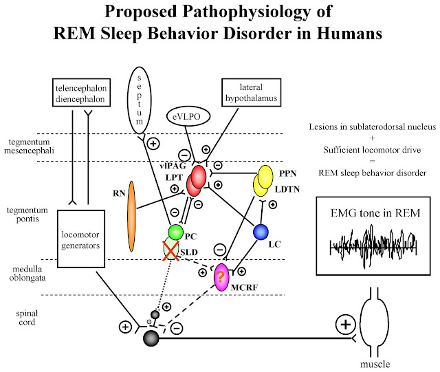 AMEINNN Y NEUROCIENCIAS Trastorno Conductual del sueño REM