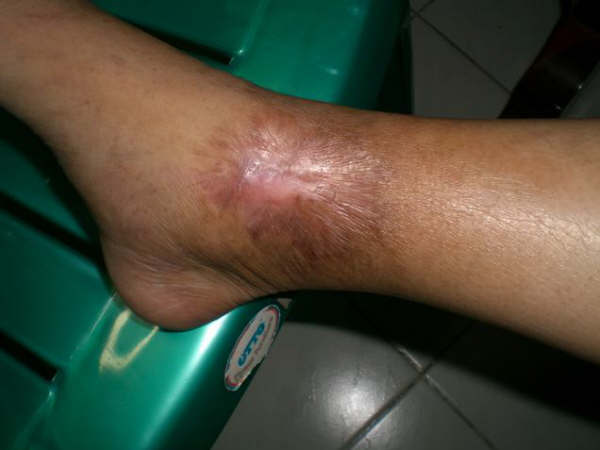 [=?windows-874?B?x9G04sq4wzExNS5qcGd=?=-779454]