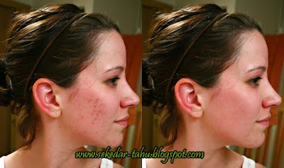 http://2.bp.blogspot.com/_6wWAvMOB4eQ/TQE3iGL65bI/AAAAAAAADE0/Op6K3jbY0CE/s1600/1.jpg