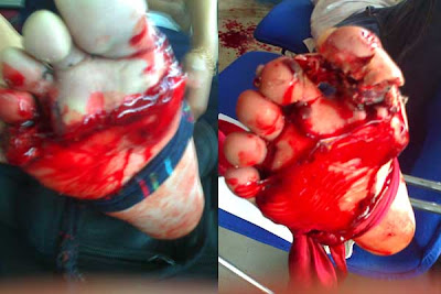 Kemalangan Tempat Kerja