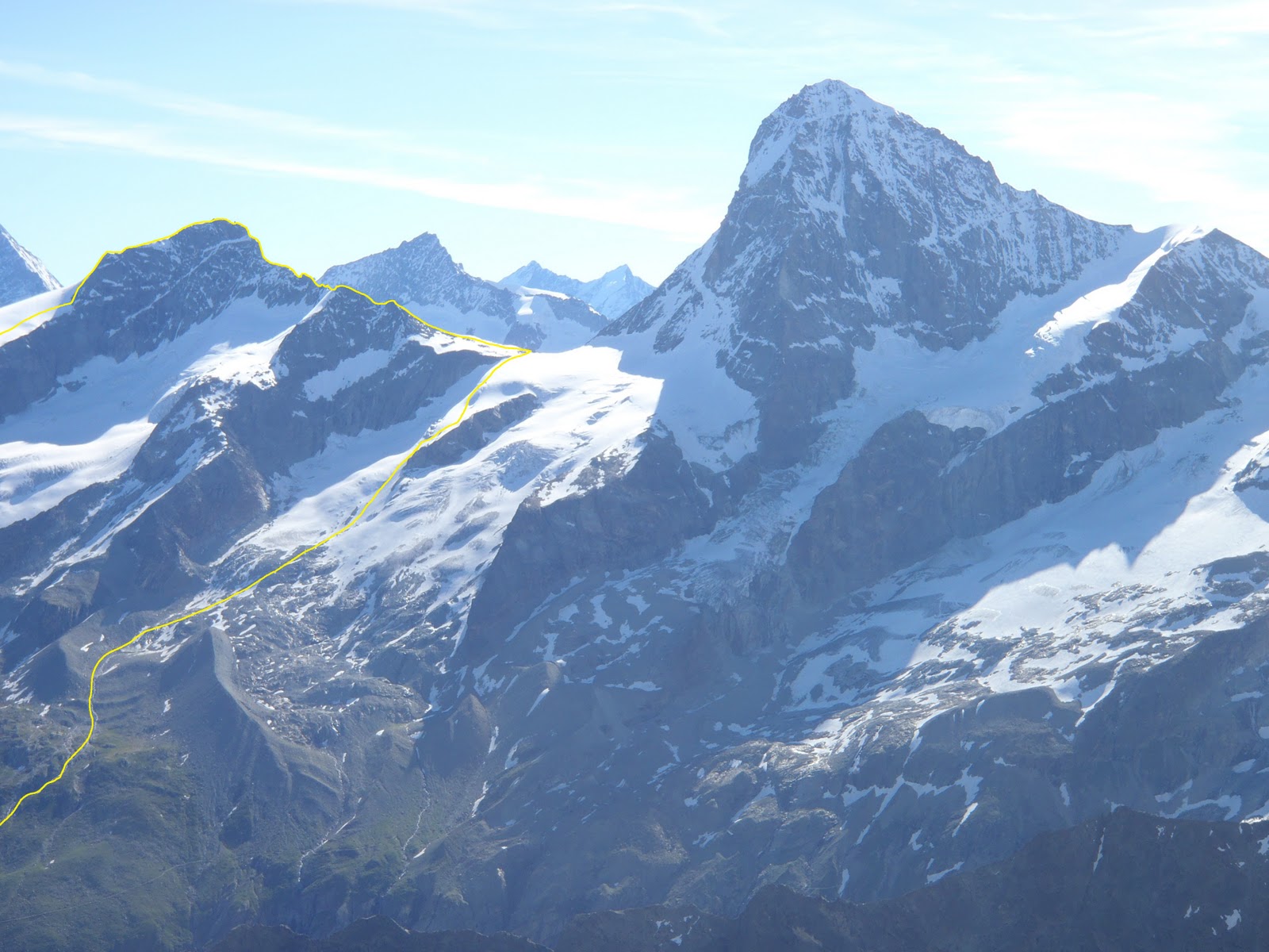 Col De La Dent; Collet de la dent; Collet dentaire; Collet des dents; Jonction cémentémail