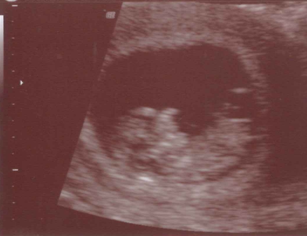 This scan was done 19th