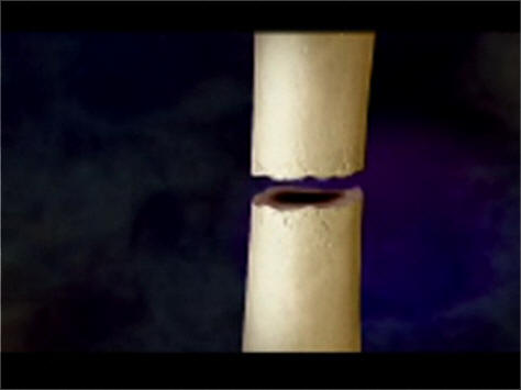 Anatomy2hour: Bone Fractures