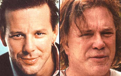 Mickey Rourke Plastic Surgery on Mickey Rourke Plastic Surgery Jpg