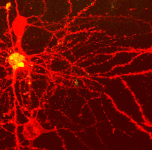 redneuron